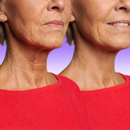 Mennuri - Invisible Neck Lifting Tape