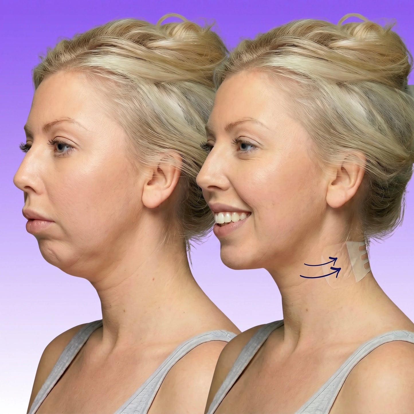 Mennuri - Invisible Neck Lifting Tape