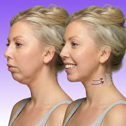 Mennuri - Invisible Neck Lifting Tape