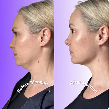 Mennuri - Invisible Neck Lifting Tape